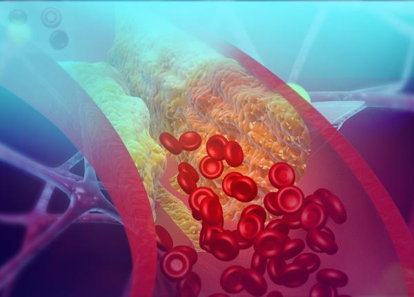unele persoane cu niveluri normale de colesterol dezvolta boli de inima la o varsta frageda oamenii de stiinta au o posibila explicatie