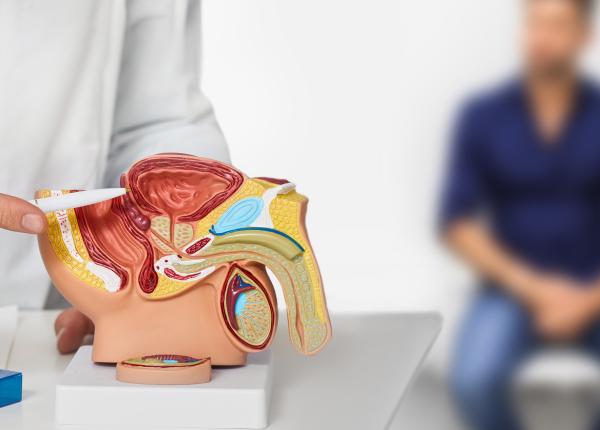 studiu cazurile de cancer de prostata se vor dubla pana in 2040