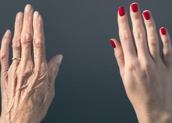 nota de plata vine intotdeauna de ce sanatatea din tinerete decide calitatea batranetii